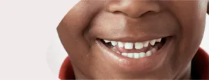 Pedodonzia per la cura dei denti da latte